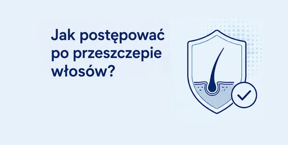 Czego unikać po przeszczepie włosów? Najczęstsze błędy pacjentów